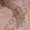 patologia apicola